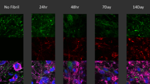Human iPSC-derived neurons seeded with ATTO594 labelled alpha synuclein PFFs (SPR-322-A594)