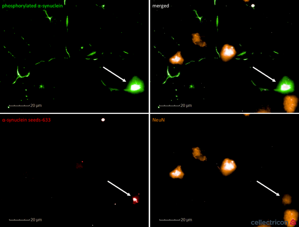 <p>Confocal imaging shows NeuN+ (mature) primary cortical neurons filled with ATTO633 fluorescently-labelled alpha synuclein PFFs (SPR-322). ATTO-633 alpha synuclein PFFs seed endogenous alpha synculein phosphorylation after 7 days. Experiment and imaging courtesy of Cellectricon.</p>
