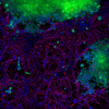 StressMarq’s Alpha Synuclein PFFs (red) cat#SPR-322, were shown to be taken up by SH-SY5Y cells and transmitted to neuronal iPSCs within 14 days.