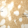 IHC of Sprague-Dawley rat brain injected with Type 1 human alpha synuclein Pre-formed Fibrils (SPR-322)