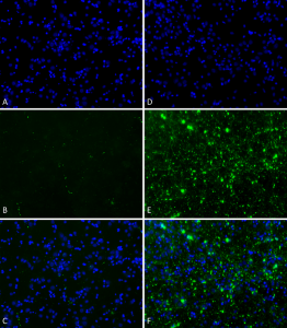 Primary rat hippocampal neurons show lewy body inclusion formation when treated with Type 1 Alpha Synuclein Protein Pre-formed Fibrils (SPR-322) (D-F), but not when treated with Type 2 Alpha Synuclein Protein Pre-formed Fibrils (SPR-317) (A-C).