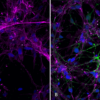 Immunocytochemistry/Immunofluorescence of Human Alpha Synuclein Protein Protein (SPR-322)