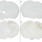 SPR-323_Alpha-Synuclein-Protein-IHC-1.png