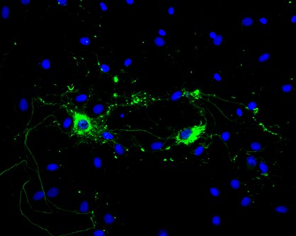 Rat primary hippocampal neurons treated with mouse Type 1 alpha synuclein PFFs show Lewy body inclusions