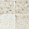 IHC of mouse brain injected with alpha synuclein monomers and fibrils