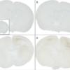 IHC of mouse brain injected with alpha synuclein monomers and fibrils