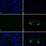 SPR-324_Alpha-Synuclein-Protein-Preformed-Fibrils-ICC-IF-1.png