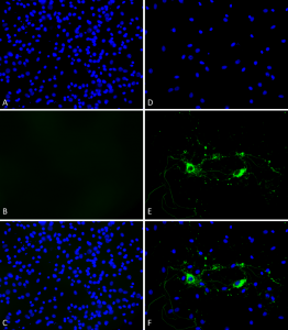 Primary rat hippocampal neurons show lewy body inclusion formation when treated with Type 1 mouse Alpha Synuclein Protein Preformed Fibrils (SPR-324) (D-F), but not when treated with a control (A-C).