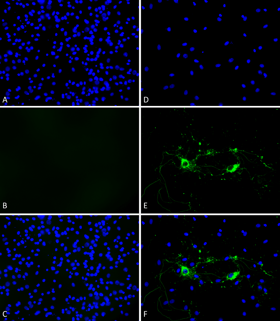 <p>Primary rat hippocampal neurons show lewy body inclusion formation and loss of cells when treated with Type 1 mouse Alpha Synuclein Protein Pre-formed Fibrils (SPR-324) at 4 µg/ml (D-F) on DVI2, but not when treated with a control (A-C). Tissue: Primary hippocampal neurons. Species: Sprague-Dawley rat. Fixation: 3% formaldehyde from PFA for 20 min. Blocker: 1:1 PBS:LiCOR Odyssey Block (LiCOR, 927-40010) and 30 mL/mL of 0.1% triton-X 100 for 30 min. Primary Antibody: Mouse anti-pSer129 Antibody (1:1000) and Rabbit anti-pSer129 (1:800) for 24 hours at 4°C. Secondary Antibody: ATTO 546 Donkey Anti-Mouse (1:700) and ATTO 488 Donkey Anti-Rabbit (1:700) for 1 hour at RT (composite green). Counterstain: Hoechst (blue) nuclear stain at 1:3000 for 1 hour at RT. Localization: Lewy body inclusions. Magnification: 20x.</p>
