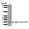 SDS-Page of Type 1 Mouse Recombinant Alpha Synuclein Protein Pre-formed Fibrils (SPR-324)