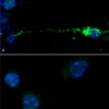 Mouse hippocampal neurons treated with mouse alpha synuclein PFFs show phosphorylation