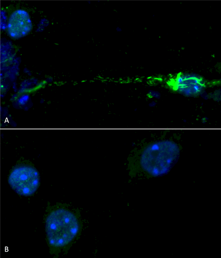 <p>Primary mouse hippocampal neurons treated with 100 nM sonicated mouse alpha synuclein PFFs (SPR-324) (A). Phosphorylated alpha synuclein (detected with pSer129 antibody SPC-742) was visible in perinucleus and neurites compared to untreated control (B). Read the protocol at pabmabs.com/?p=7901. Image courtesy of Trine Rasmussen, Simon Molgaard Jensen at Aarhus University.</p>
