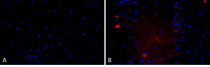 Primary rat hippocampal neurons show Lewy body inclusion formation when treated with A53T mutant Alpha Synuclein Protein Preformed Fibrils (SPR-326) (B) but not when treated with a media control (A). Tissue: Primary hippocampal neurons. Species: Sprague-Dawley rat. Primary Antibody: Rabbit anti-pSer129 Antibody. Fibrils were diluted to 1 ug/uL in neuronal media consisting of B27, Glutamax, penicillin/strip, and neurobasalA and sonicated for 1 hour in a water bath. The sonicated stock was then used to achieve the final concentration of 1 ug/mL in the wells.