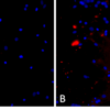 ICC of primary rat neurons treated with A53T alpha synuclein PFFs show Lewy body inclusion formation.