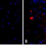 SPR-326_A53T-Alpha-Synuclein-Preformed-Fibrils-Protein-ICC-IF-1.png