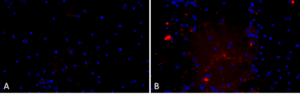 SPR-326_A53T-Alpha-Synuclein-Preformed-Fibrils-Protein-ICC-IF