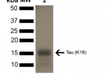 SDS-PAGE of ~16 kDa Human Tau K18 P301L Monomer