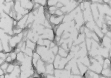 TEM of recombinant Tau441 (2N4R), P301S mutant Pre-formed Fibrils (PFFs)