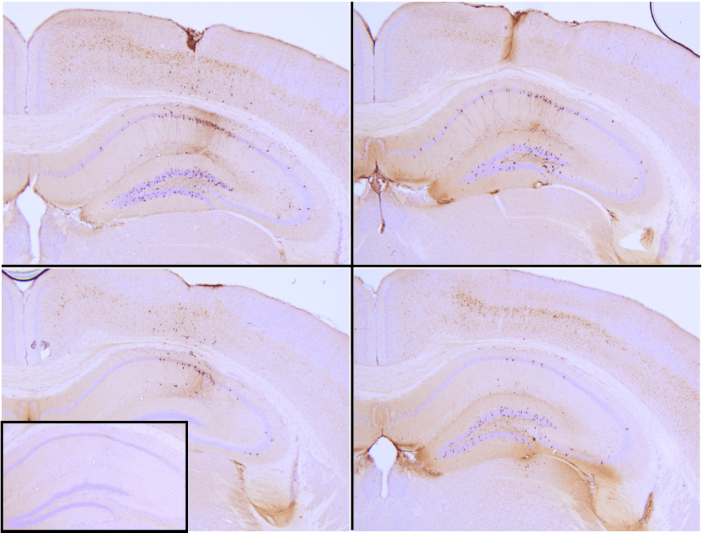 SPR-330 Tau Preformed Fibrils Protein IHC