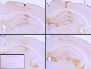 SPR-330 Tau Preformed Fibrils Protein IHC