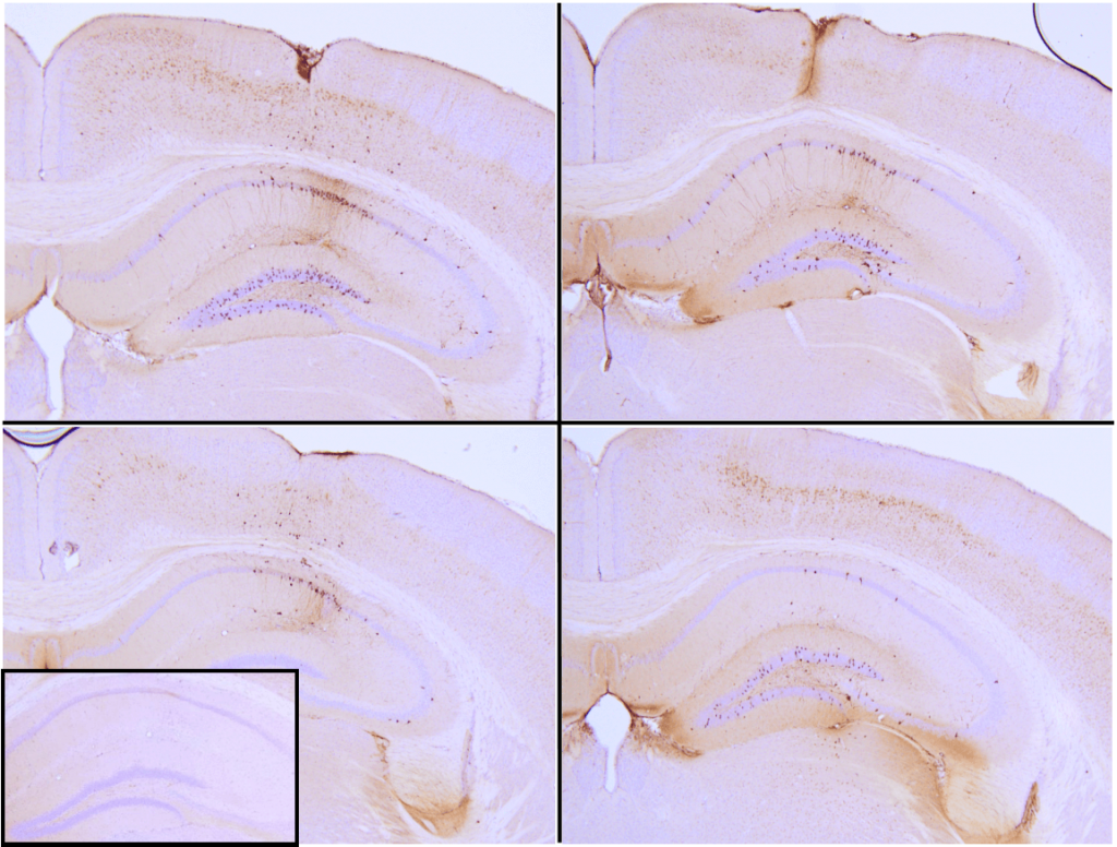 SPR-330_Tau Preformed Fibrils Protein IHC-1