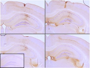  Immunohistochemistry analysis of P301L mouse hippocampus injected with K18 P301L tau PFFs (BHP11900160) shows seeding of tau pathology at injection site nine weeks post-injection. AT8 (pSer202/pThr205) tau antibody shows tangle-like inclusions. Inset: negative control. Experiments performed at reMYND N.V.