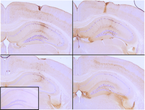 SPR-330_Tau Preformed Fibrils Protein IHC-1