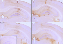 IHC of P301L mouse brain injected with K18 P301L tau PFFs shows seeding of tau pathology after injection in the hippocampus.