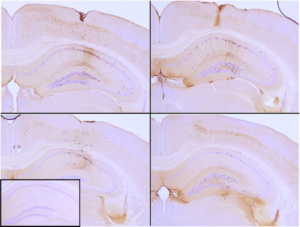 IHC of P301L mouse brain injected with K18 P301L tau PFFs shows seeding of tau pathology after injection in the hippocampus.