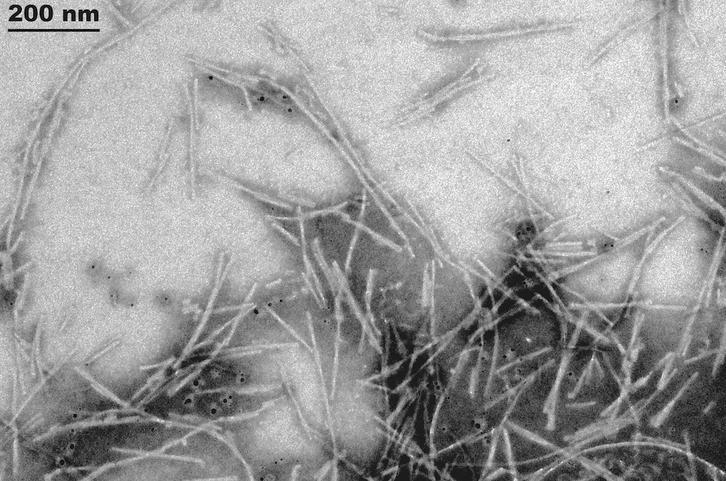 <p>TEM of Active Human Recombinant Alpha Synuclein Protein Pre-formed Fibrils (Type 3) (SPR-448)</p>
