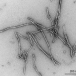 SPR-448_Alpha-Synuclein-Protein-Preformed-Fibrils-Protein-TEM-2.png