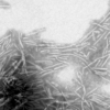 TEM of Active Human Recombinant Alpha Synuclein Protein Filaments (SPR-450)