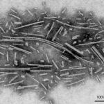 SPR-450_Alpha-Synuclein-Protein-Filaments-Protein-TEM-2.png