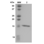 SPR-451_Transthyretin-Protein-SDS-PAGE-1.png