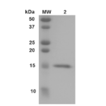 SPR-452_Transthyretin-Protein-SDS-PAGE-1.png