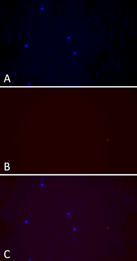 <p>Primary rat hippocampal neurons treated with human beta synuclein Pre-formed fibrils (SPR-457) do not show Lewy body inclusion formation. Fibrils were sonicated 1 hour and added at 1 ug/mL concentration. A) Hoechst. B) pSer129. C) Merge.</p>
