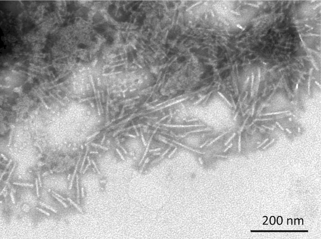 <p>TEM of Active Human Recombinant Beta Synuclein Protein Pre-formed Fibrils (Type 1) (SPR-457)</p>
