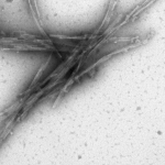 SPR-462_Tau-Preformed-Fibrils-Protein-TEM-1.png