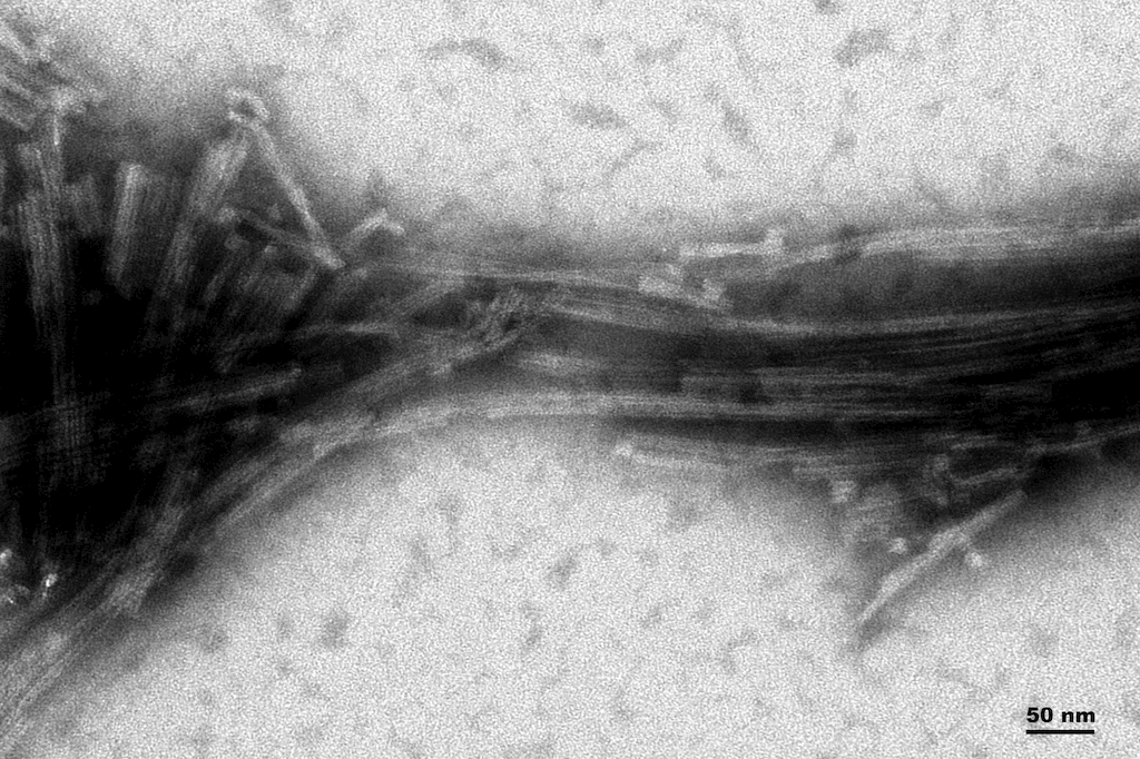 <p>TEM of Active Human Recombinant Truncated Tau (AA297-391) (dGAE C322A) Protein Pre-formed Fibrils  (SPR-462)</p>
