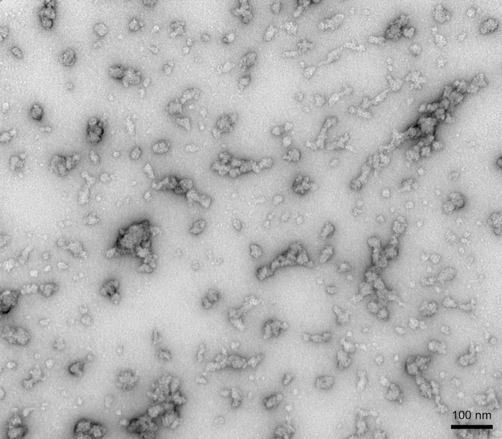 <p>TEM of Human Recombinant Alpha Synuclein Oligomers (Dopamine HCL Stabilized) (SPR-466)</p>
