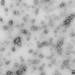 SPR-466_Alpha-Synuclein-Oligomers-Protein-TEM-1.png