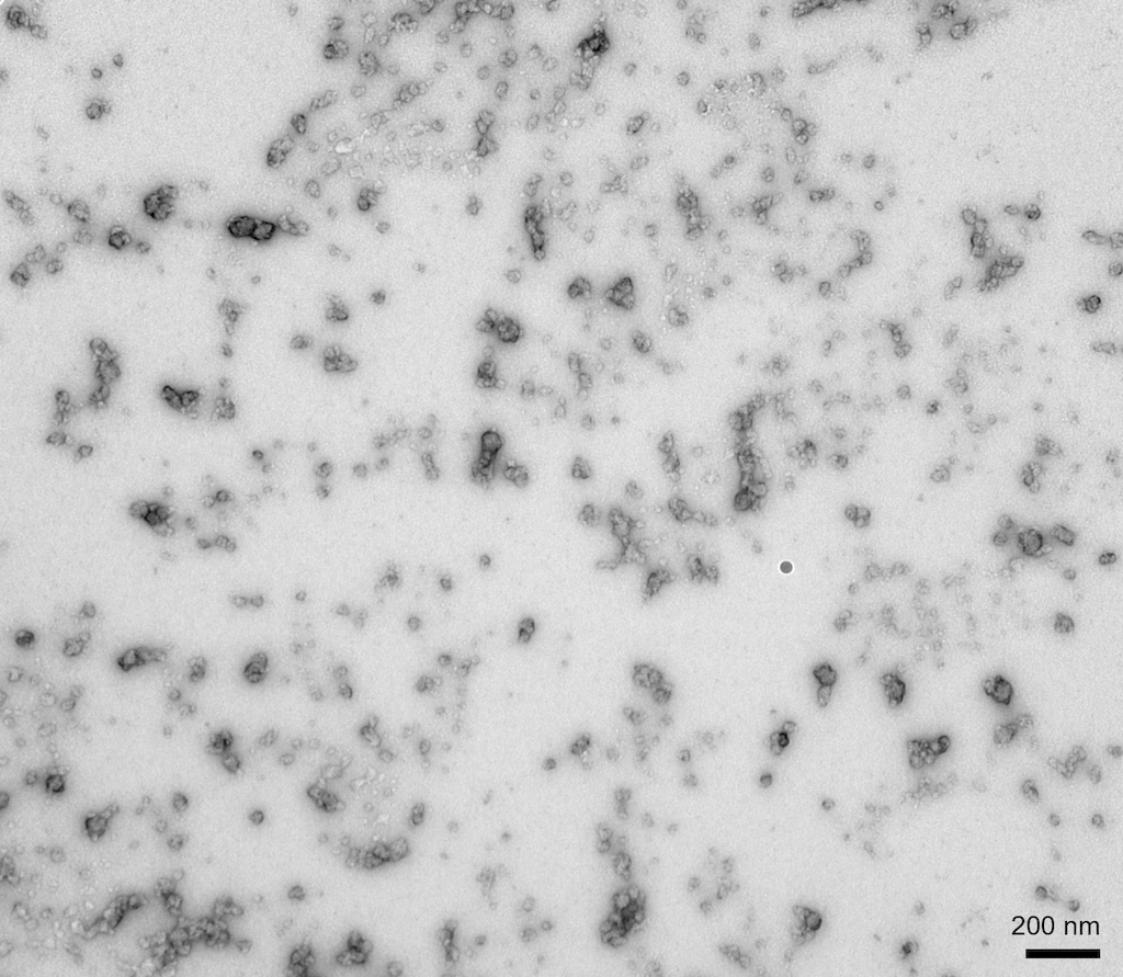 <p>TEM of Human Recombinant Alpha Synuclein Oligomers (Dopamine HCL Stabilized) (SPR-466)</p>
