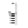 Native SDS-PAGE of EGCG-stabilized alpha synuclein oligomers (SPR-469)