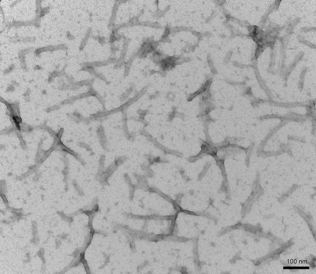 <p>TEM of recombinant Tau441 (2N4R), P301S mutant Pre-formed fibrils (PFFs) expressed in baculovirus</p>
