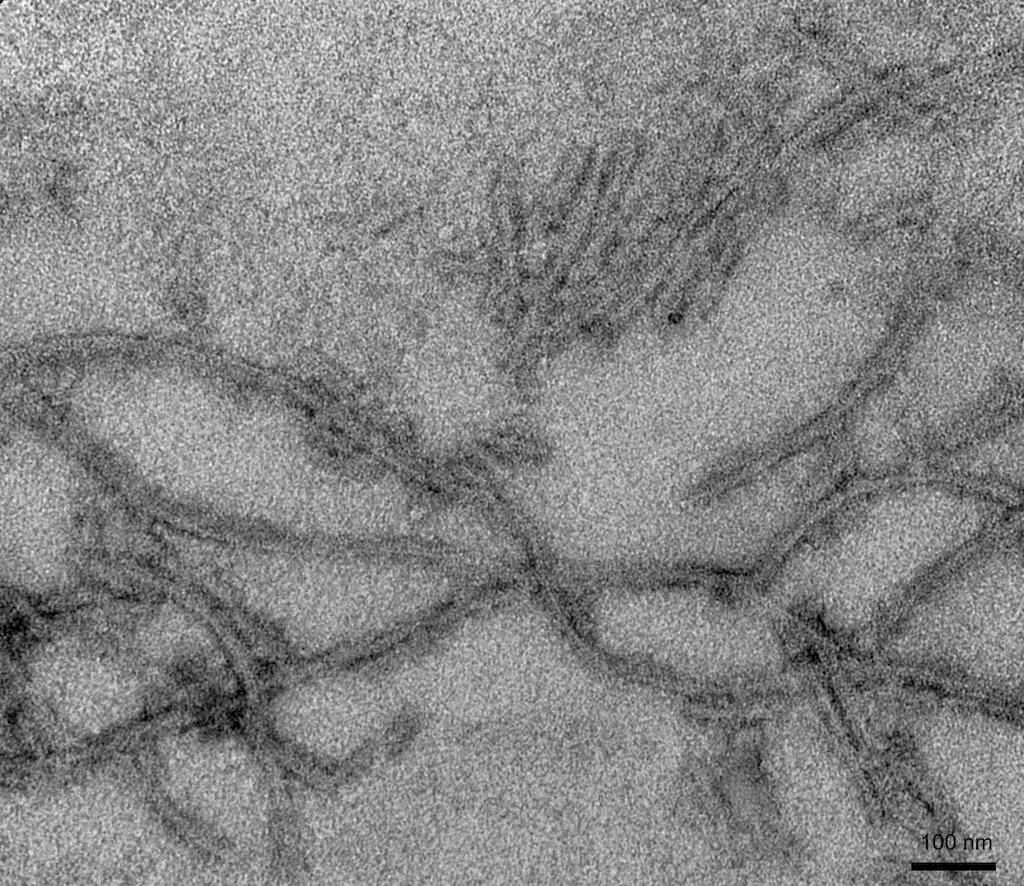 <p>TEM of Mouse Tau430 (2N4R) P290S Pre-formed Fibrils (PFFs) (SPR-475)</p>
