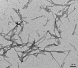 SPR-477_Tau-Protein-Protein-TEM