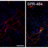 IHC of Human Recombinant Alpha Synuclein Oligomers (Kinetically Stable) (SPR-484).