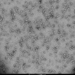 SPR-484_Alpha-Synuclein-Oligomers-Kinetcially-Stable-Protein-TEM-1.png