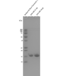 SPR-499_Human-Recombinant-Alpha-Synuclein-S87N-Mutant-Monomers-Protein-SDS-Page-1.png