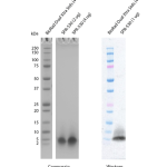 SPR-530_Amyloid-Beta-Peptide-1-40-Monomers-Protein-SDS-Page-1.png